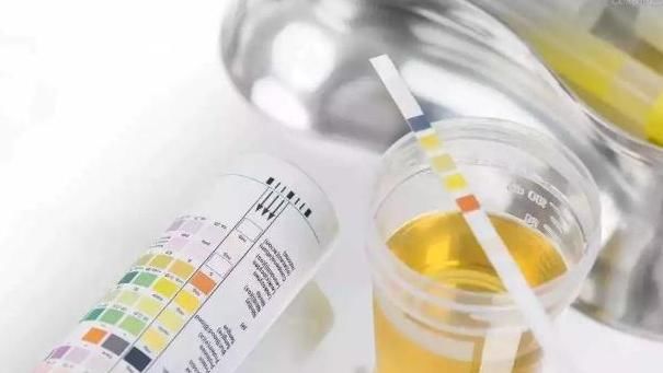  尿酸含量|高尿酸人群想要控制尿酸，牢记：做好3件事，尿酸不升反降