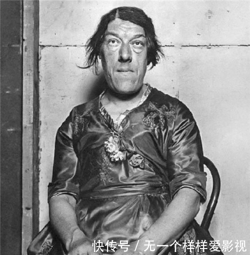 赚钱|母爱有多伟大?“怪物”玛丽为孩子参加选丑比赛,用自己外貌赚钱