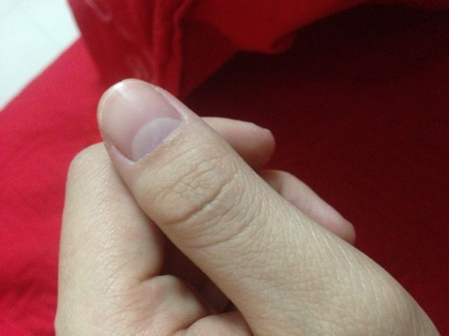 月牙|为什么有的人指甲上有月牙?有的人一个都没有?科学的解释来了