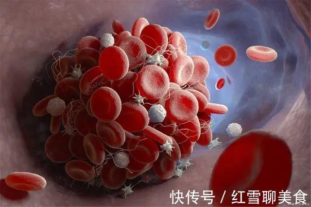 血糖|45岁男子糖尿病入院，肾衰去世，医生：1事放纵，血糖易“飙升”