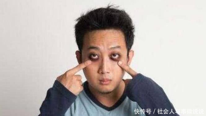 qt:levelH|“肾”不好的男生,头上会出现“3个现象”,希望你一个都没有!