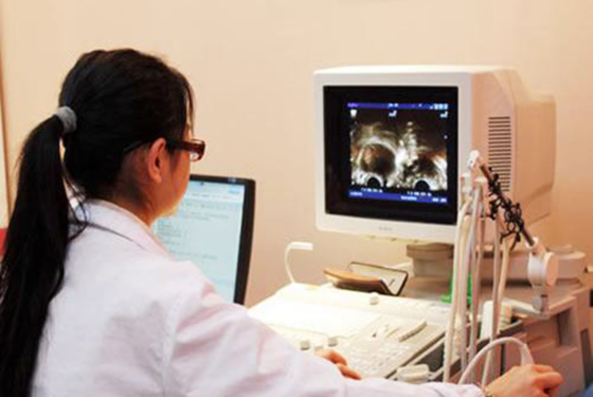 孕囊|孕早期B超单上的四个指标，暗含了胎儿的“小秘密”，你看得懂吗