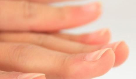 指甲上出现“竖纹”是怎么回事？是好还是坏？