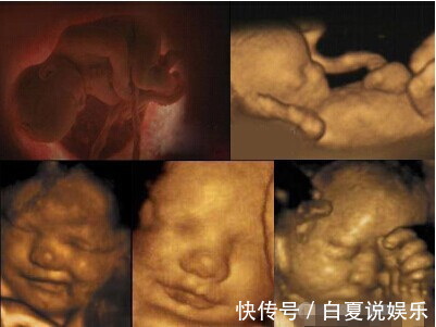 哭声|怀孕32周孕妈经常深夜听见婴儿哭声，被吓懵，检查时医生却乐了