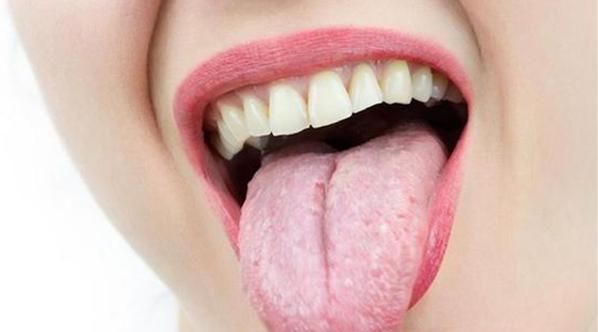 水分|身体若出现以下3个表现,说明体内湿气很重,该祛湿排毒了!