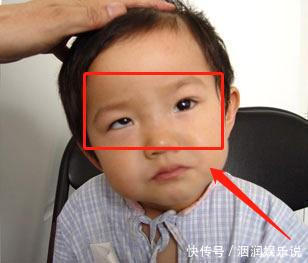 电子产品|5岁男童老玩这类玩具,导致黑眼珠逐渐“消失”,家长要注意