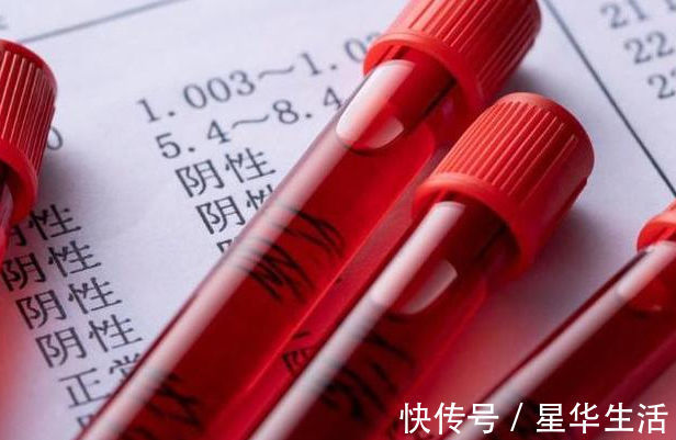 红薯|糖尿病人吃红薯,到底会升高血糖,还是降血糖?看完或许更明白