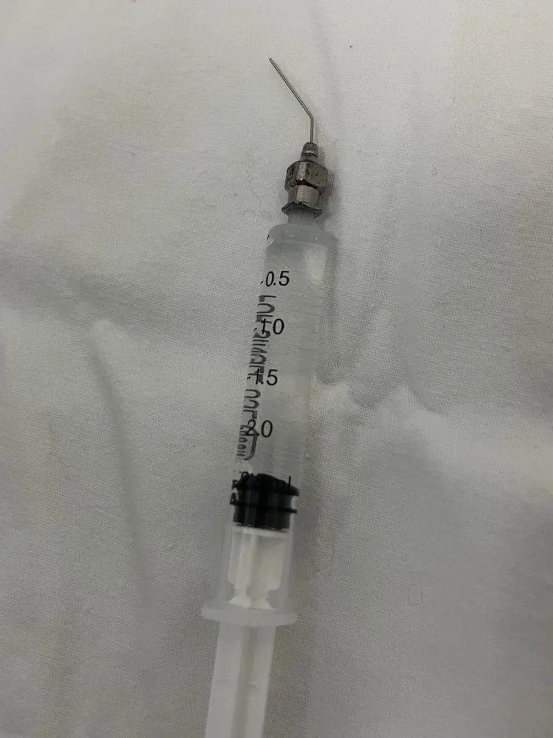 泪道|眼角抽出5管脓液,宝宝眼睛经常“泪汪汪”居然是病!拖延治疗严重的可能失明