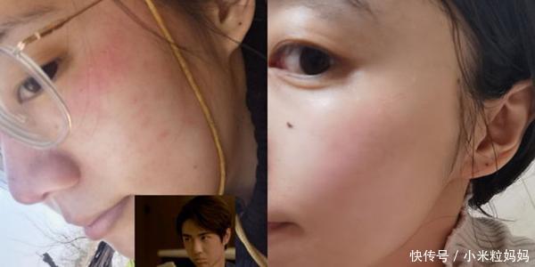 坚持护肤,悄悄变美!拥有神仙级护肤品是变美第一步,孕妇也一样