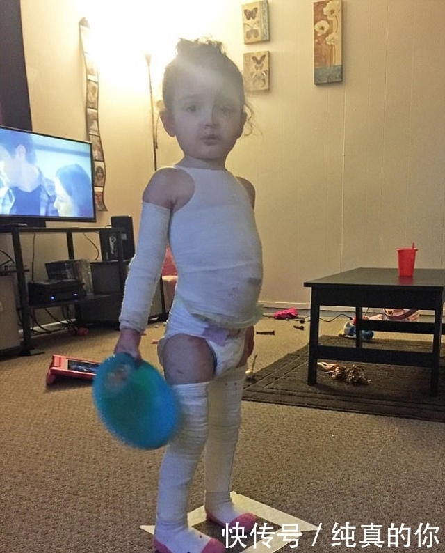 父母|父母每天将三岁女儿包裹成木乃伊,网友知道真相后感动落泪!