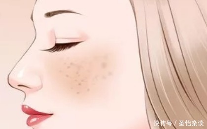 脸上斑点越来越多是什么原因?