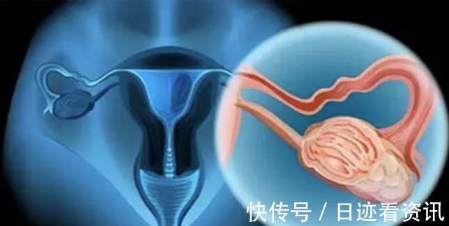 维c|吃一口等于一瓶维C,医生提醒HPV的人不妨多吃,远离宫颈癌