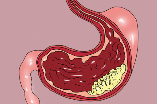 体检查出炎症后，如果拖着不治疗会怎样？医生：4种炎症不要拖