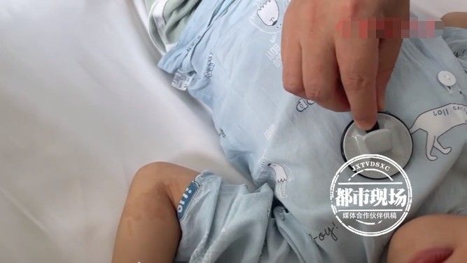 浩浩|十月大婴儿一运动就嘴唇发紫，医生：孩子心脏有问题