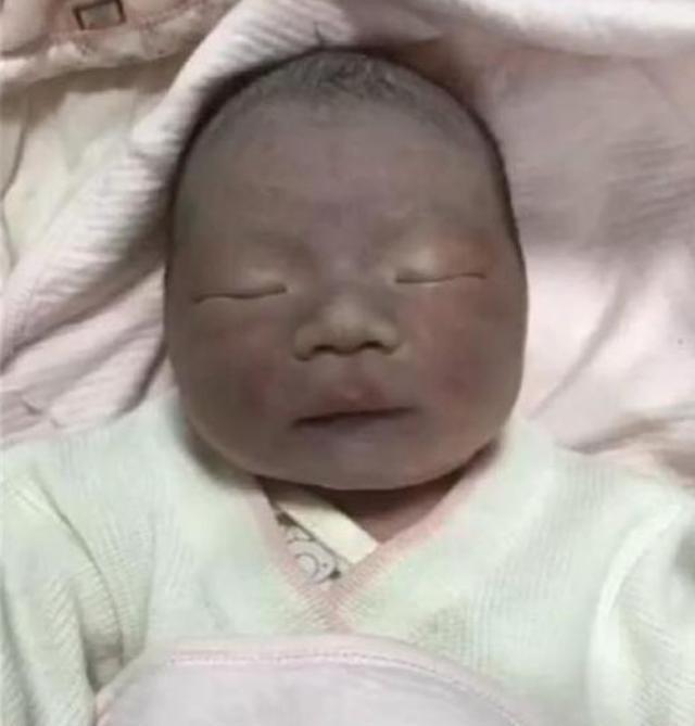 逆袭|90后宝妈生下“包公”宝宝，亲戚们都说丑，三个月后实现“逆袭”