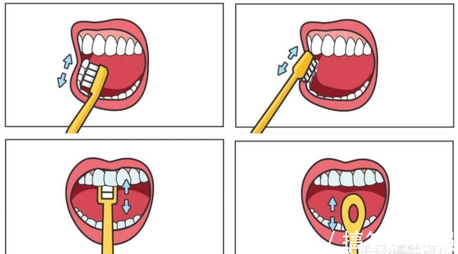 黑牙|3岁男童不吃糖,却长了一口黑牙,牙科医生说都怪父母瞎胡闹