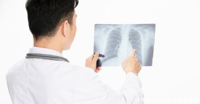 儿童做ct,x光,核磁共振对他们身体生长发育有多大影响?