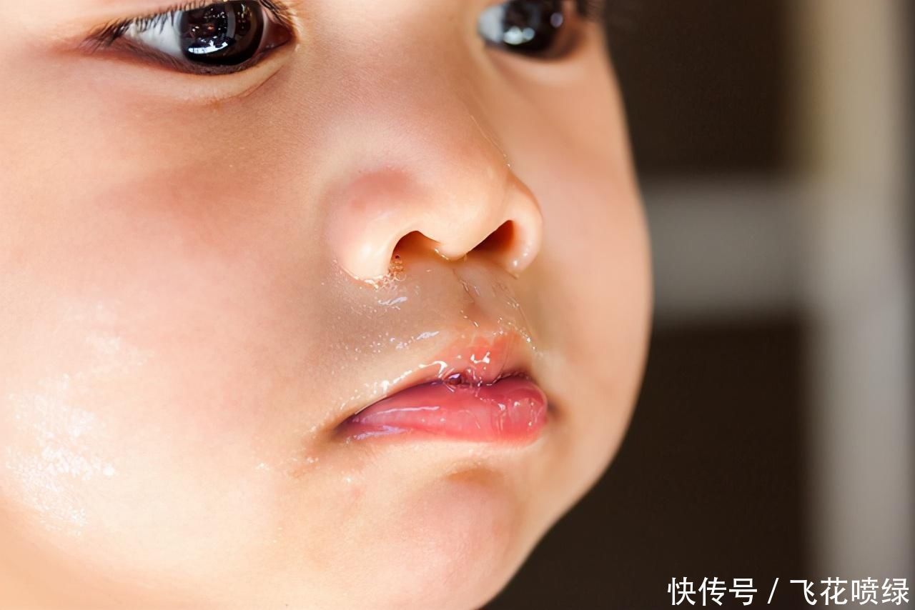 健康状况|从鼻涕看健康状况孩子出现这4种症状,家长应及时带他去医院