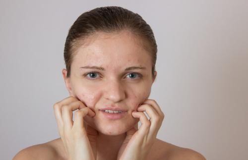 食物|经常吃鸡蛋会加剧黄褐斑吗？若不想脸部长斑，建议少吃这3种食物