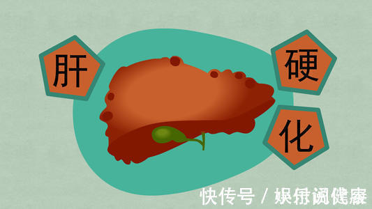 医生|肝硬化怎么来的？肝病医生：都是睡前这四个习惯害的