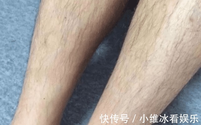 女性|为什么有的女性体毛旺盛,有的却一点也没有?哪种情况好?