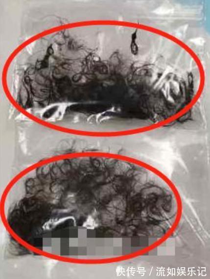 父母|3岁女儿经常干呕,医生花16个小时手术,肚里取出的异物让人后怕