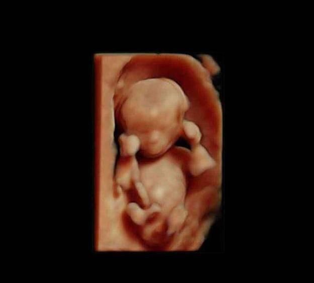 性别|胎儿从卵泡到性别形成,17张图片清晰诠释,男宝女宝看得很清楚