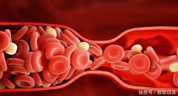 泡水|它被称为天然的“阿司匹林”,每天泡水喝,血管干净血栓悄悄走远