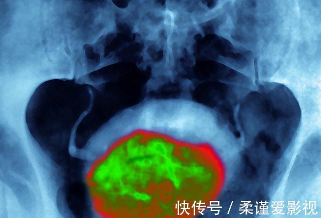 番茄|前列腺炎“劲敌”找到了！想要养护身体，男性不妨多吃一点