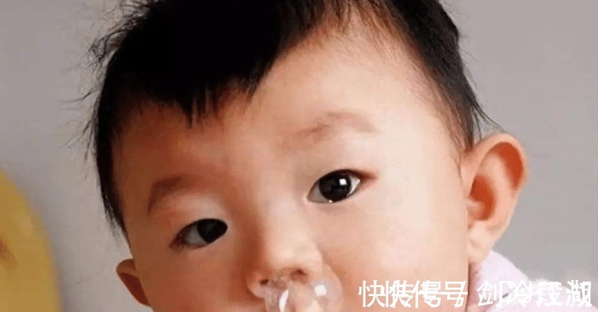 过敏|男子流“鼻涕”五年以为是过敏, 滴到碗里后才“发现”是脑脊液