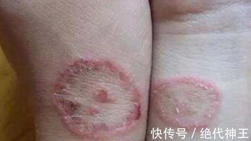 男子|男子在海上钓鱼,几小时后离奇死亡,医生给出诊断,家人捶打女儿