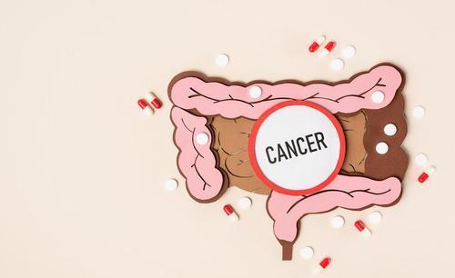麻辣烫|经常放屁是肠癌的警示吗？肿瘤科医生说：这4个症状才是肠癌信号