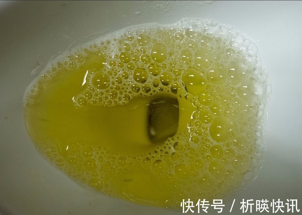 肝脏健康|肝不好的人,会出现5个异常,养肝坚持“三步走”,肝好你更好