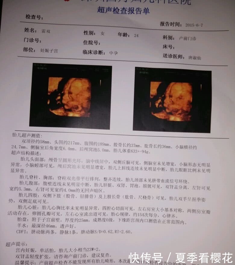 信号|提醒孕妈若孕期出现3种“信号”，多半怀有“小少爷”几率大！