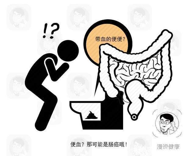 临床所说|大肠出现癌细胞,往往排便有这4大共性!年过40岁劝你悠着点
