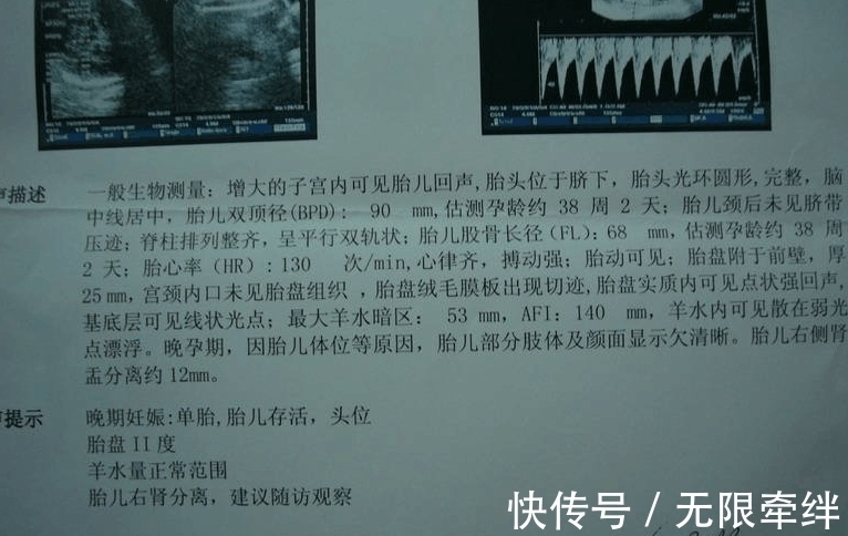 胎心|去医院孕检时, 看到B超单子上的这4个字, 你怀的多半是个小王子