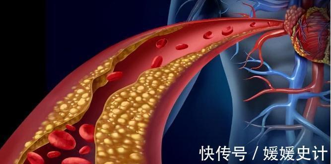 体检|70岁老人血压、血脂、血糖一直都正常,反而还不好,为什么?