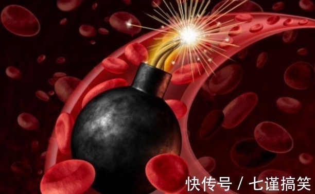 血管|35岁男子吃粗粮降脂,脑梗复发,医生:2种粗粮吃一口等于喝一桶油