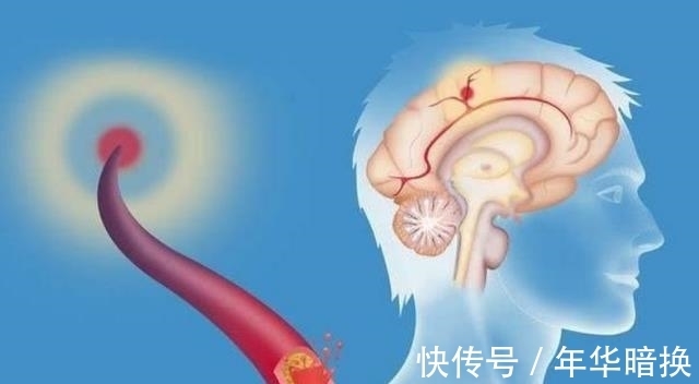 保护血管|脑供血不足的人，平时可以多吃这3种蔬菜，或有助于改善