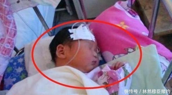 孩子|刚出生宝宝身上有“黑刺”,宝妈细心全拔掉,医生斥责太无知