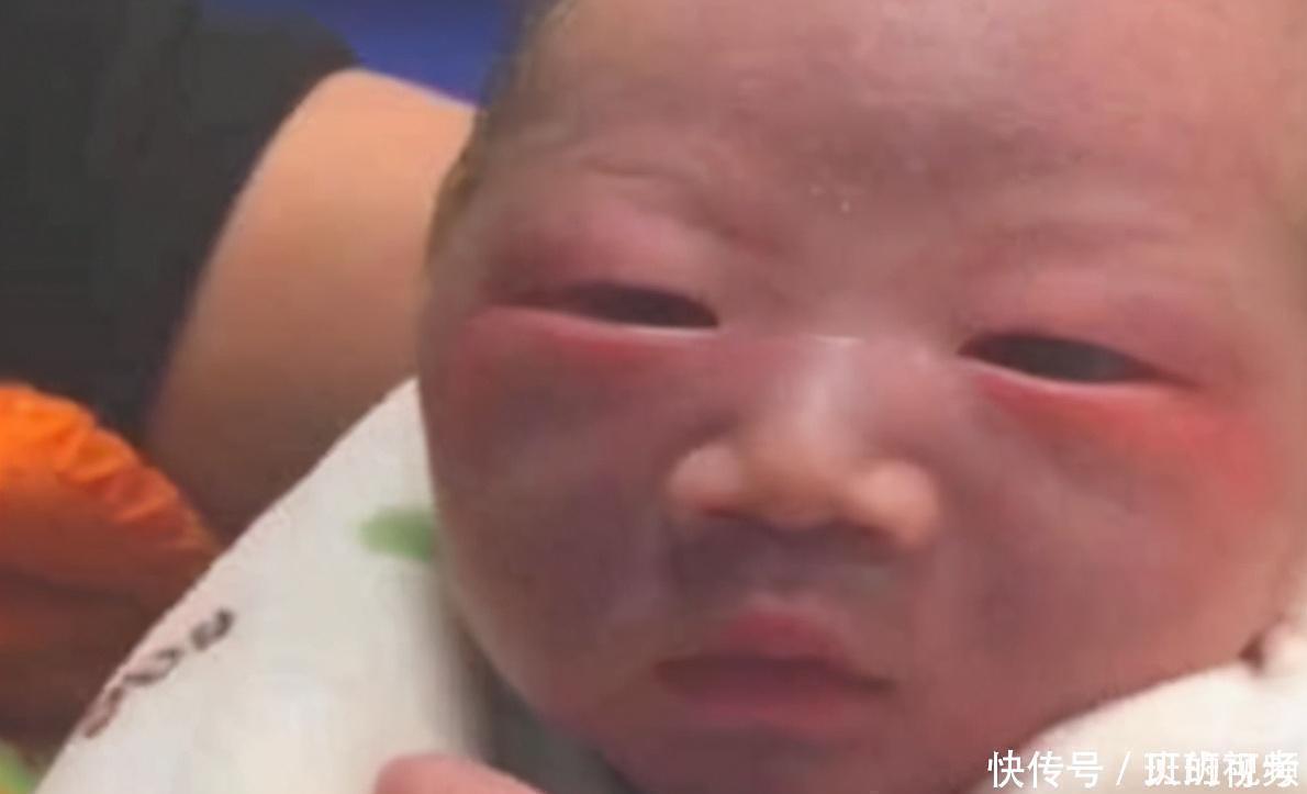 孩子|“丑娃”出生时宝爸满脸嫌弃,护士却说好看,一月之后态度大变样