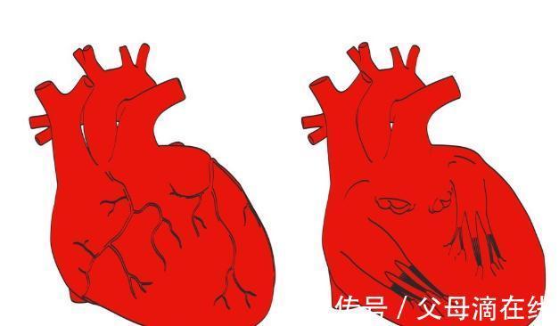 袖带|测量血压，躺着量还是坐着量？听听医生怎么说