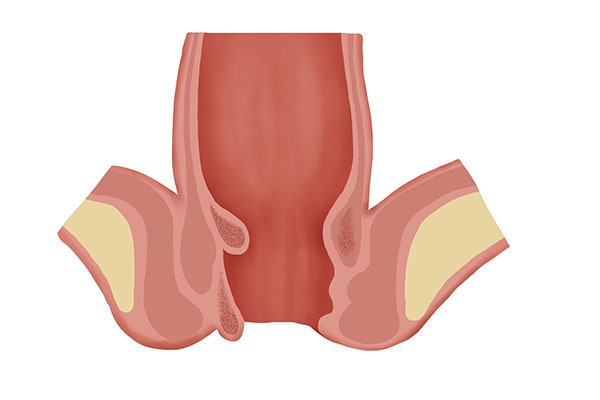 痔疮|为什么男人喜欢提肛运动每天提肛50次,三个月后,惊喜连连