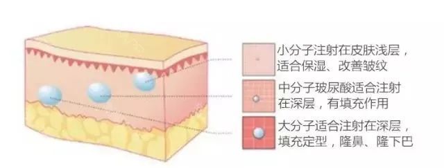 科普篇|水光针和玻尿酸，你更适合哪个？| 交联