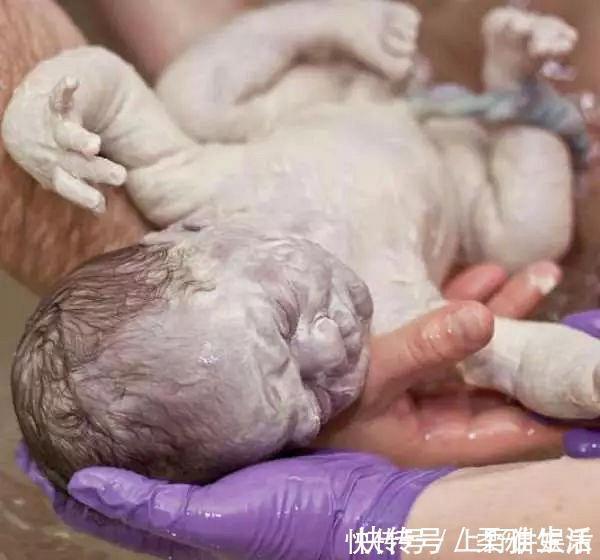 胎脂|新生儿全身涂满“猪油”,母子相见吓坏产妇医生这是好事