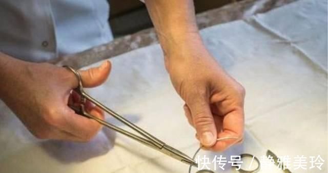 生育能力|不想生二胎了上环还是结扎,看完这两位宝妈的遭遇你会选什么?