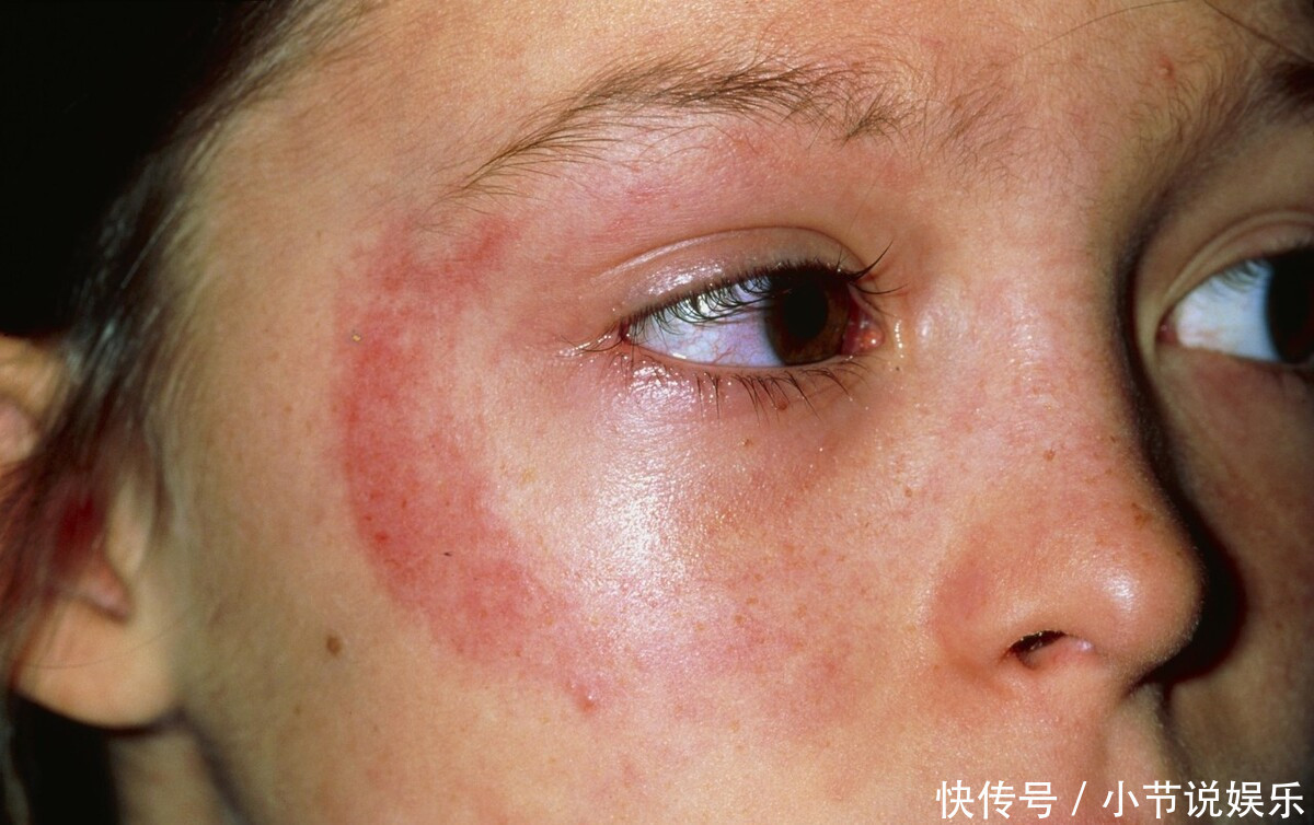 硫磺皂与普通肥皂有何不同可以长期使用硫磺皂洗脸吗一文说清