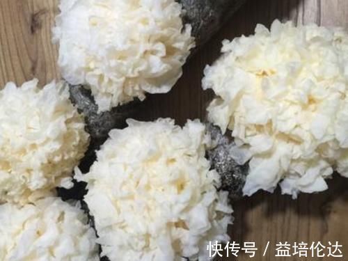 黄疸|孕妈注意胎毒“最讨厌”4物,每天多吃点,预防宝宝“黄疸”有奇效