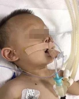 溺水|一个炒菜的功夫孩子就没了医生泣血忠告这些底线千万不要让孩子碰