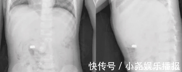 孩子|“妈妈我肚子里能长出钱”,话刚说完,宝妈就带娃直奔医院